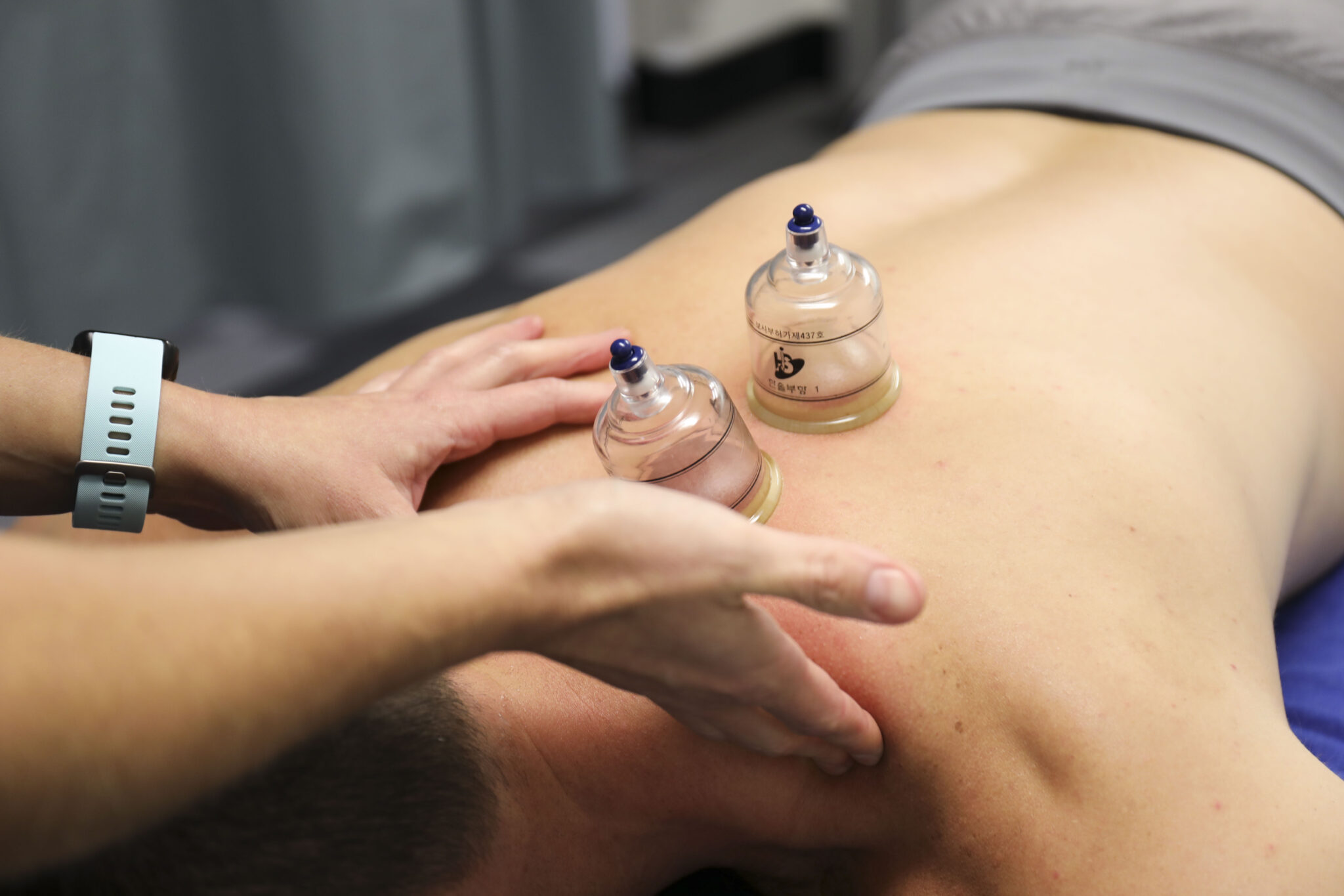 Physical therapist doing cupping on athlete